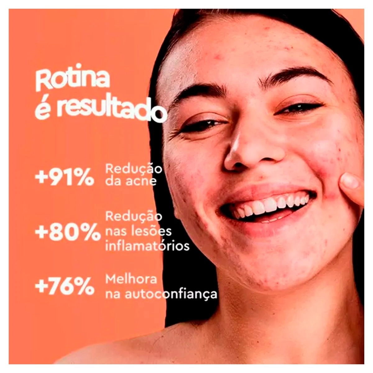 Acnezil Secativo Bifásico Com 20ml Cimed